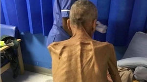 A murit bărbatul care cântărea 38 de kg, trimis de stat la muncă!