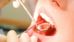 INCREDIBIL! O femeie a murit pe scaunul dentistului dupa ce a folosit apa de gura!