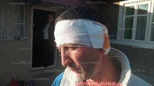 ȘOCANT! Un bărbat din Vaslui i-a mușcat urechea prietenului său și a mâncat-o: “Eram plin de sânge...“