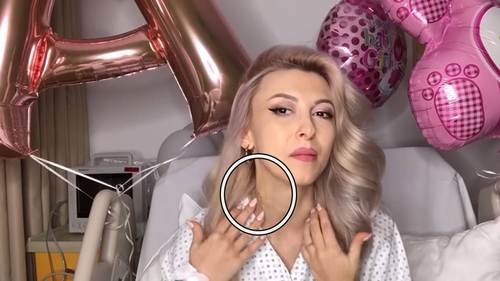 Andreea Bălan, plină de vânătăi! Lupta cu moartea i-a lăsat urme pe corp! Imagini greu de privit