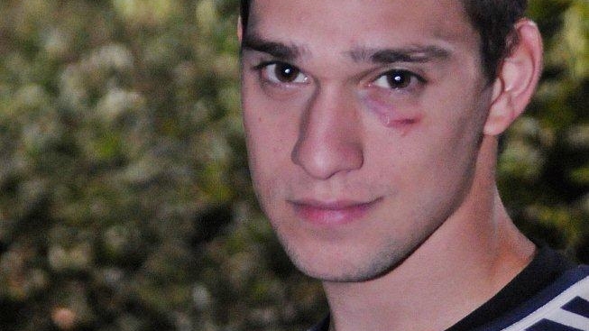 Vlad din "Pariu cu viaţa" a rămas cu un semn la ochi după filmările pentru episodul cu atentatul! Vezi ce i s-a întamplat!