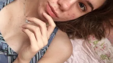 ”Când am ajuns în spital, mi s-a spus că mai am o zi până să orbesc” | Ce pastile luase de fapt fata! Atenție, ți se poate întâmpla și ție!