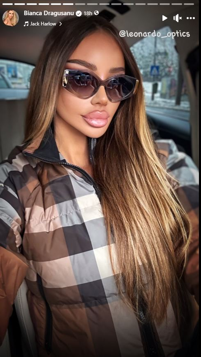 Bianca Drăgușanu a renunțat la cagulă! Cum arată fosta prezentatoare TV după operația de 11.000 de euro