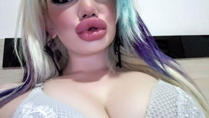 Andrea Ivanova are cele mai mari buze din lume. Cum arată după 20 de intervenții cu acid hialuronic. FOTO