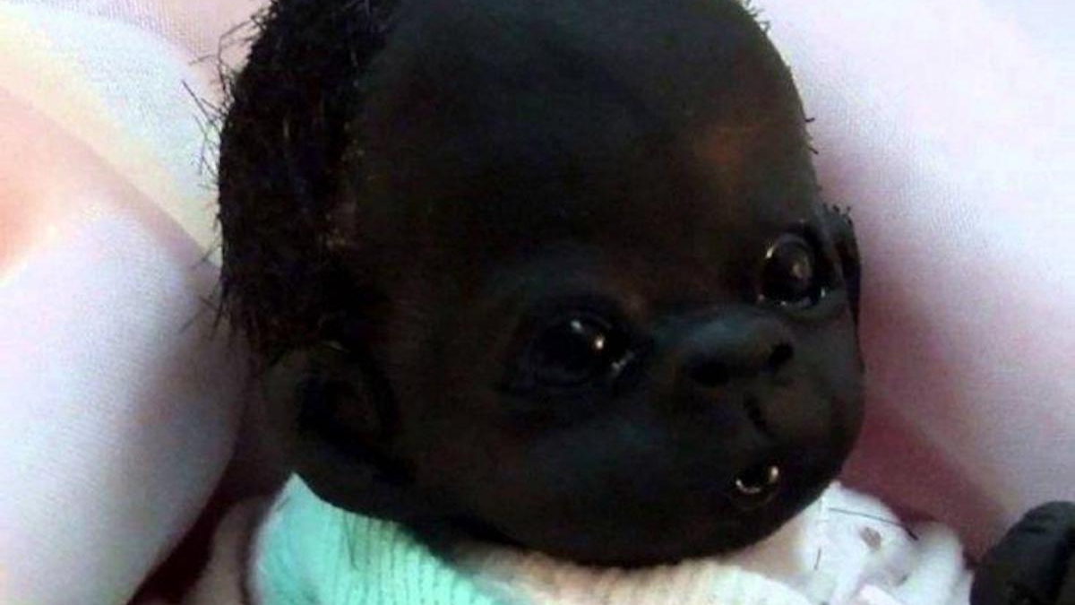 Cel mai negru copil din lume a împlinit 4 ani! Iată cum arată azi