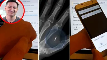 Motivul pentru care George Buhnici și-a implantat un microcip în mâna stângă: Un doctor mi l-a injectat cu o seringă