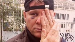 Un român a devenit erou, la Milano, după ce s-a bătut cu hoții: ”M-au lovit peste tot, cu picioare, pumni, cu ranga în față, mi-au înfipt o șurubelniță în spate!”