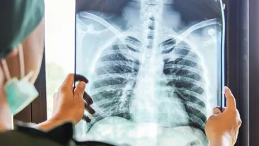 Credea că are o răceală banală și a mers la medic. Incredibil ce diagnostic a primit, de fapt