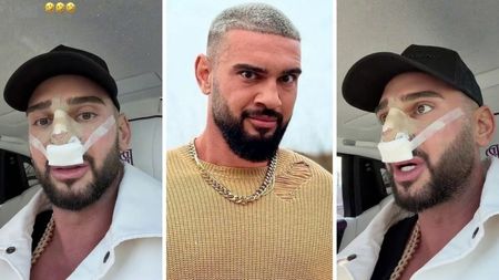 Dorian Popa, la un pas să îi „cadă nasul ca lui Michael Jackson”! Ce i-a descoperit medicul la operație? „Habar nu aveam”