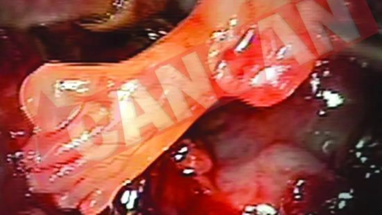 Si-a revenit spectaculos