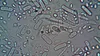 Bacteria care face tot mai multe victime în apele din America! Cinci oameni au murit deja