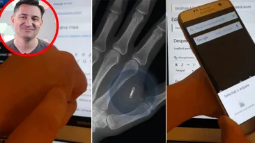 Motivul pentru care George Buhnici și-a implantat un microcip în mâna stângă: Un doctor mi l-a injectat cu o seringă