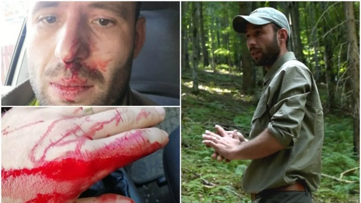 La o zi după crima din Maramureș, un alt pădurar din Suceava este bătut și amenințat cu moartea
