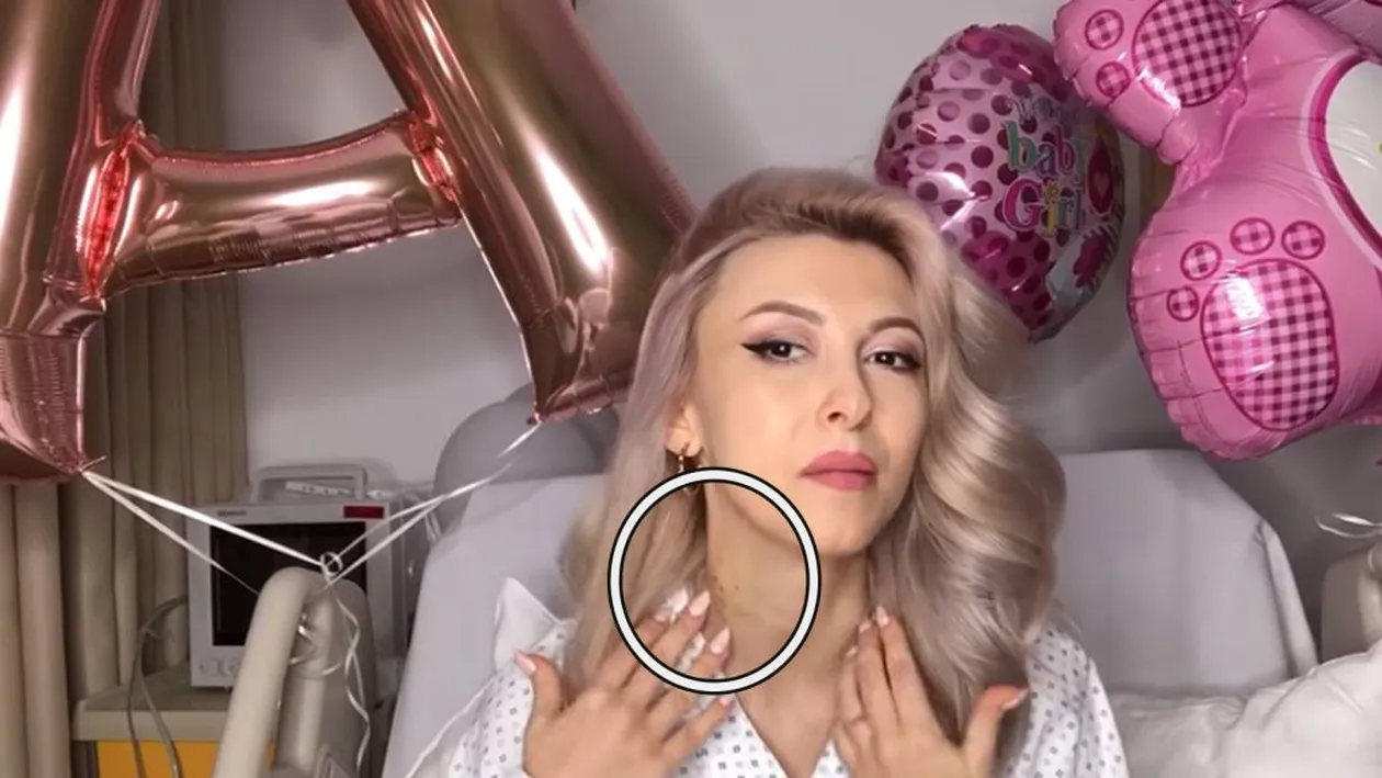 Andreea Bălan, plină de vânătăi! Lupta cu moartea i-a lăsat urme pe corp! Imagini greu de privit