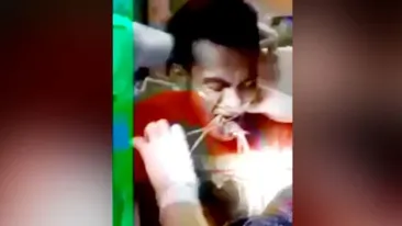 Priveşte cum medicii încearcă să-i scoată din gât un peşte viu! IMAGINI ŞOCANTE! 