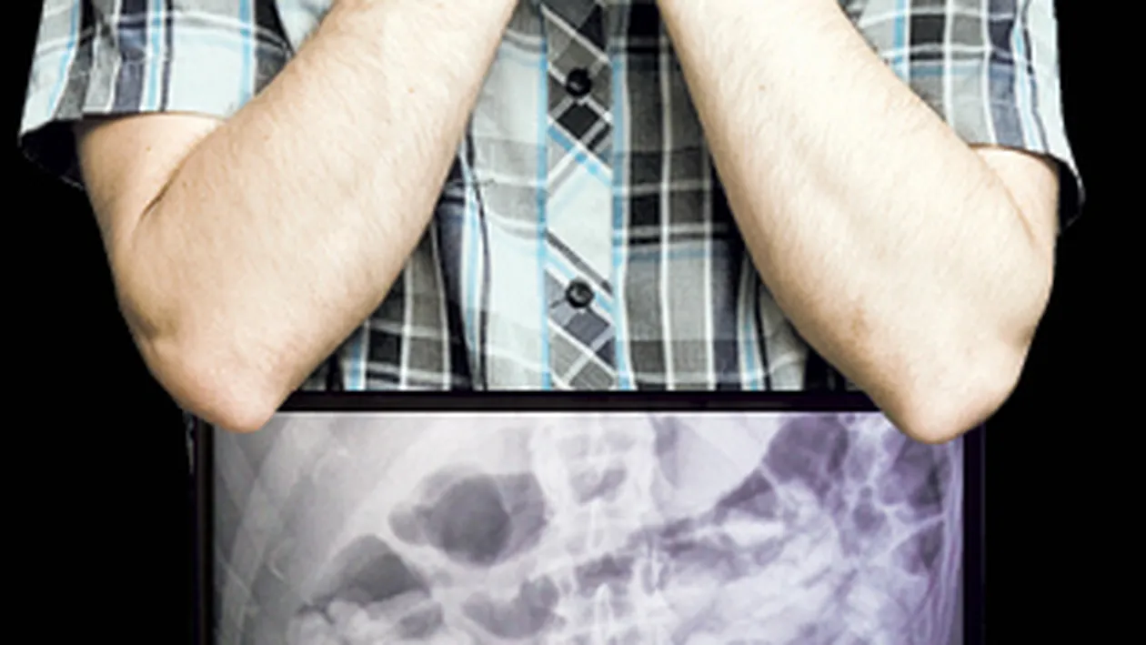 Avea stomacul burdusit cu droguri