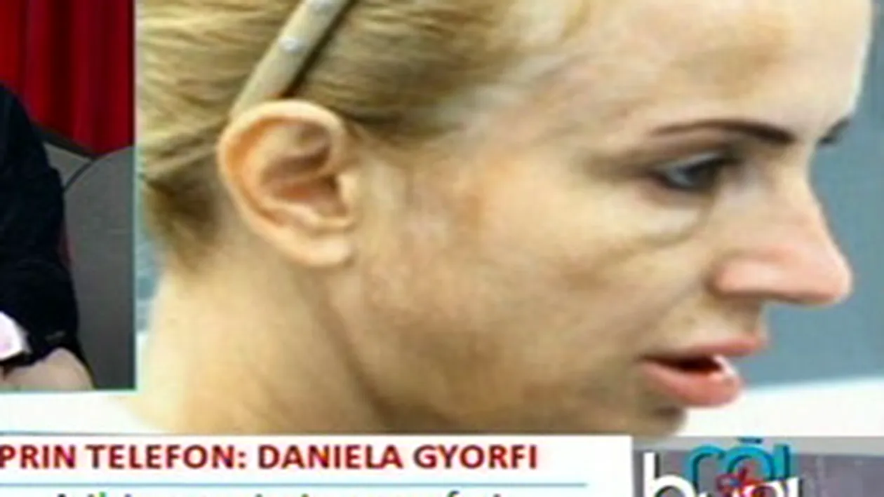 VIDEO Daniela Gyorfi, despre fotografiile in care apare cu fata distrusa: Oi fi dalmatian si nu imi dau seama!