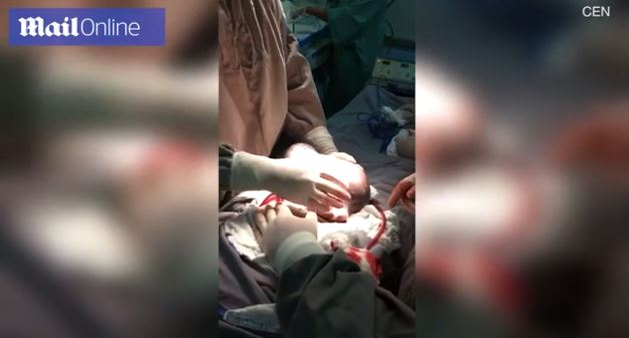 Imagini emoționante în sala de operații: un băiețel s-a născut în timp ce era încă în sacul amniotic. Cazul este foarte rar: 1 la 80.000 de nașteri | FOTO & VIDEO
