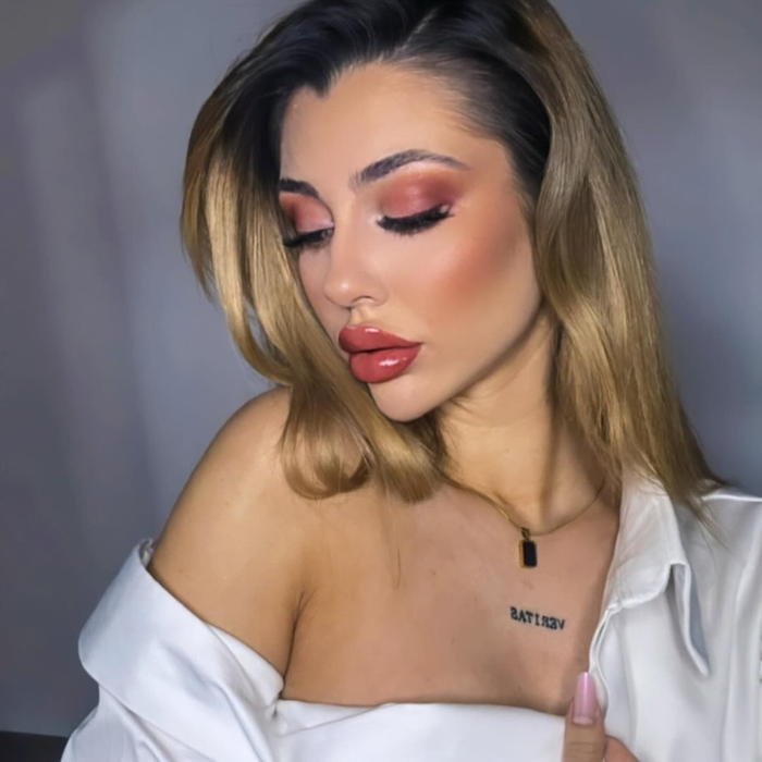 Mădălina de la Insula Iubirii și-a topit acidul din buze. Foto: Instagram