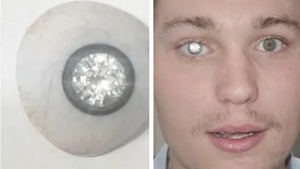 Povestea tânărului care și-a pus un diamant de 2 milioane de dolari în loc de ochi: ”A adus o lumină nouă în viața mea”