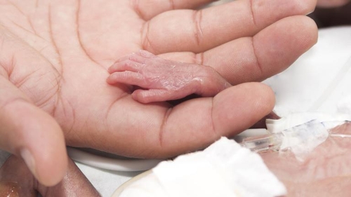 Lyla e cel mai prematur copil din lume. A fost născută în luna a cincea. Cum arată acum, după ce a crescut