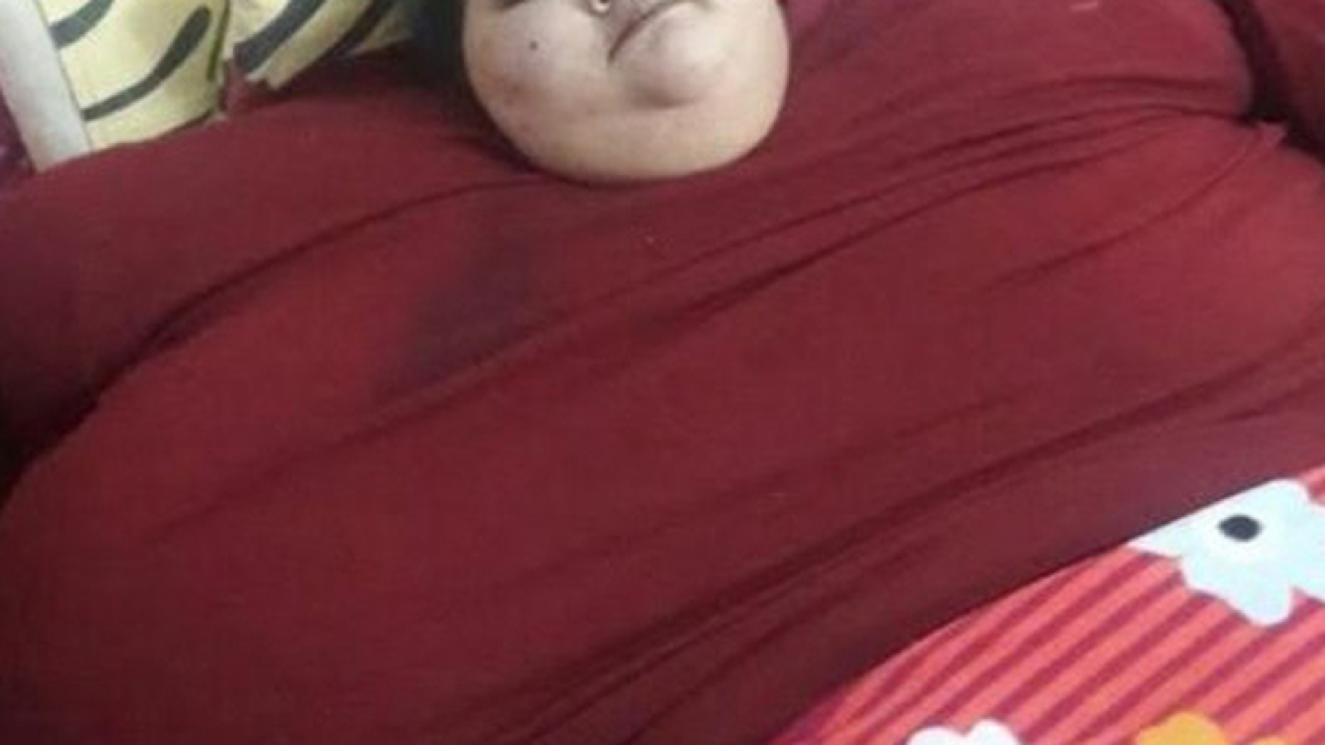 Tânăra de 500 de kilograme are şanse să fie operată! "Cea mai grea femeie din lume" va fi transportată cu o cursă aeriană specială