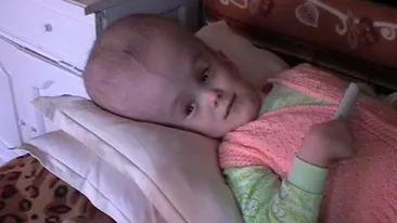 Mama baietelului cu tumora gigant refuza operatia! “Nimeni nu-mi da asigurarea ca mai iese viu”