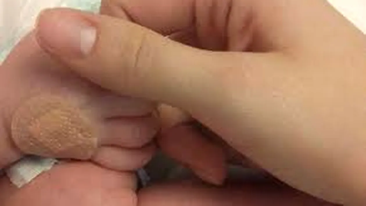 Momente teribile pentru o mamă, când și-a văzut pentru prima oară bebelușul! Copilul avea două capete și trei mâini