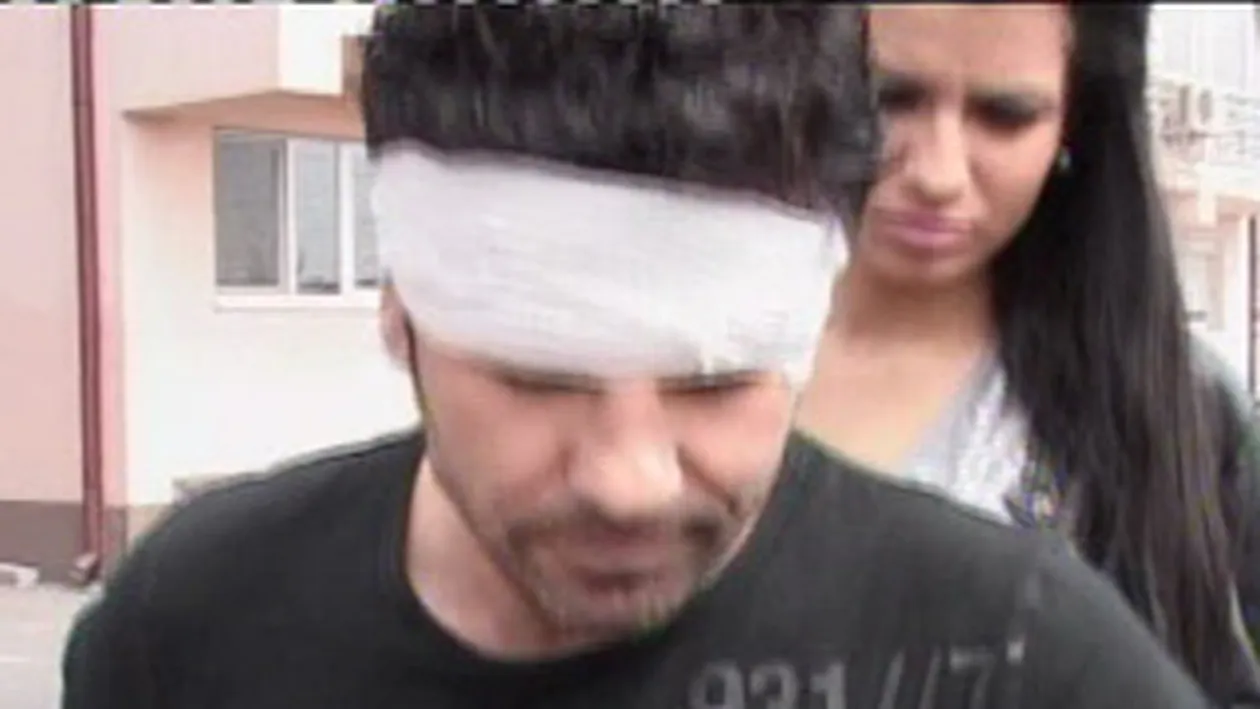 Stelian Ogica a avut un accident de motor! S-a ales cu rani grave, dar nu vrea sa renunte la pasiunea sa!