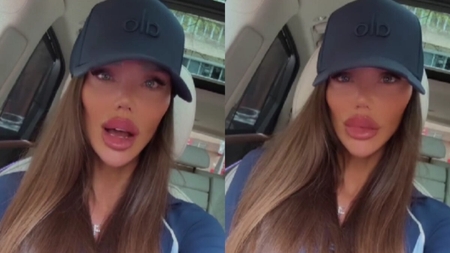 Bianca Drăgușanu tună și fulgeră! „Să nu faceți asta, niciodată, la nimeni. M-au MUTILAT!”