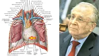 Ce este, de fapt, pericardita hemoragică, boala cu care a fost diagnosticat Ion Iliescu