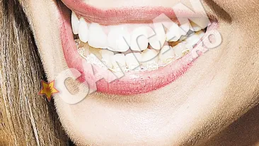 Vandici a intrat in reparatii capitale. Poarta aparat dentar si umbla cu sprancenele desenate