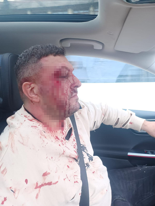 Atenție! Imagini cu un puternic impact emoțional / (Sursa: Arhivă personală)