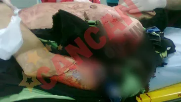 Barbatul cauia i-a fost mana taiata de tren: Mi-am vazut degetele miscand, mi-am ridicat mana si am plecat dupa ajutor