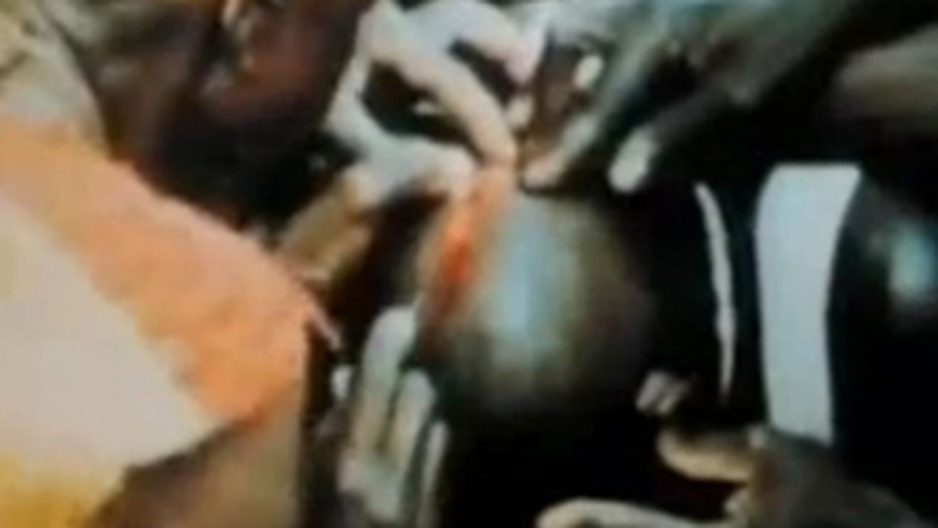 VIDEO socant! Vezi cum un vraci din Africa opereaza pe creier, pe viu!