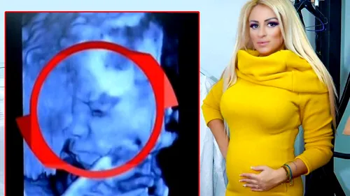 Sânziana Buruiană, însărcinată din nou?! A repostat poza cu ecografia: Botoasa mică din burtică