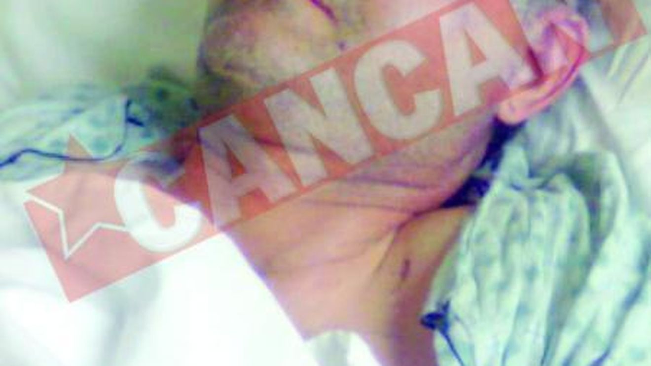 Si-a strivit craniul cand a cazut de pe schela