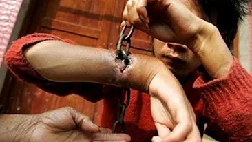 ATENTIE! Imagini socante! A fost legat atat de tare incat pielea i-a crescut peste lanturi