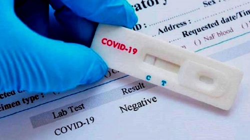 Mai mult de 3.000 de bucureşteni s-au înscris în programul de testare pentru noul coronavirus