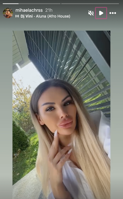 S-a tunat și a ajuns de nerecunoscut! Cum arată ispita de la Insula iubirii 2025, după ultima intervenție