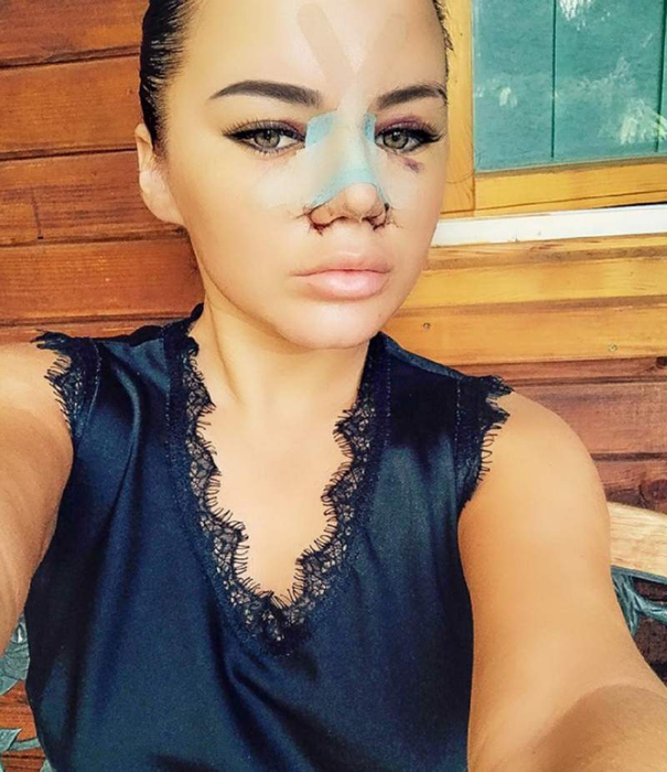 Câte operații are Carmen de la Sălciua