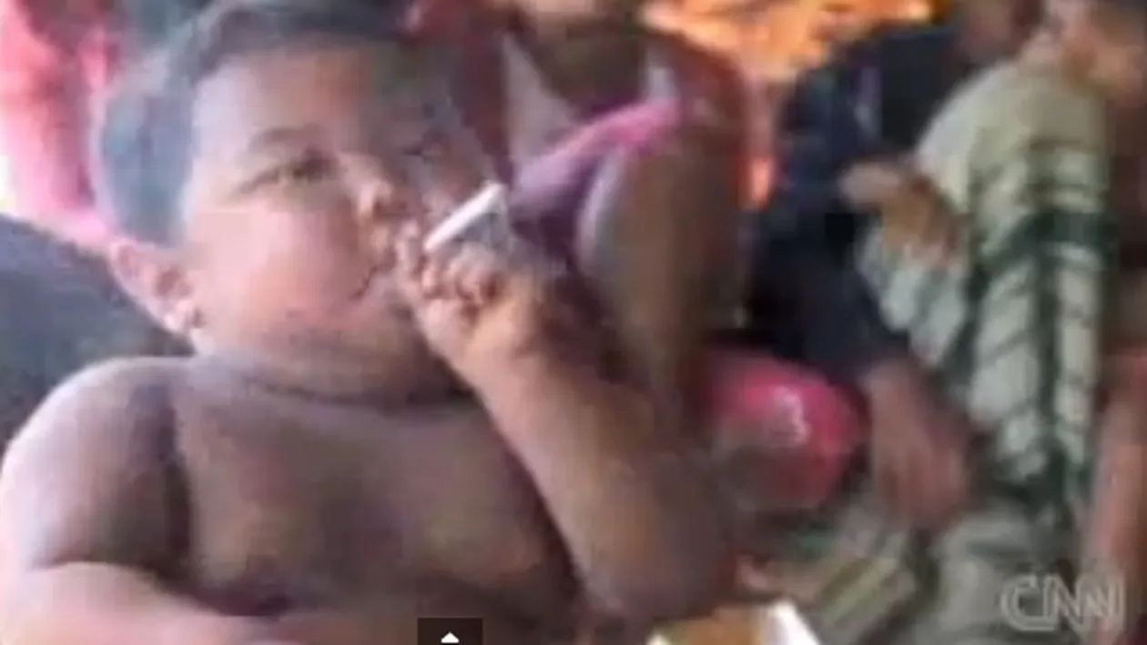 Povestea CUTREMURATORE a copilului care la varsta de 2 ani FUMA cate 40 de TIGARI pe zi! Ce s-a intamplat cu el