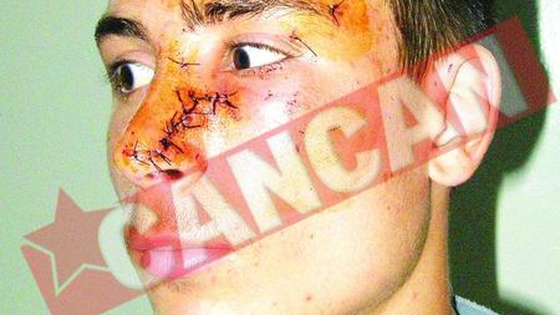 Mutilat cu un ciob, la discoteca