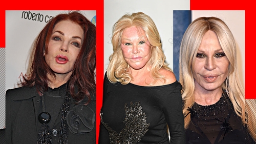 TOP 5- Vedete de la Hollywood care s-au ales cu chipul desfigurat în urma operațiilor estetice. Jocelyn Wildenstein sau Donatella Versace arată de nerecunoscut!