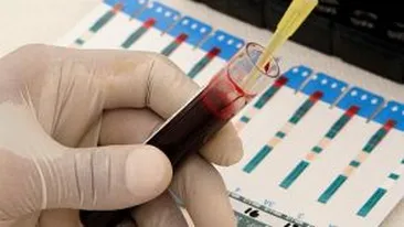 Un tânăr din Botoşani şi-a infectat intenţionat iubita cu HIV