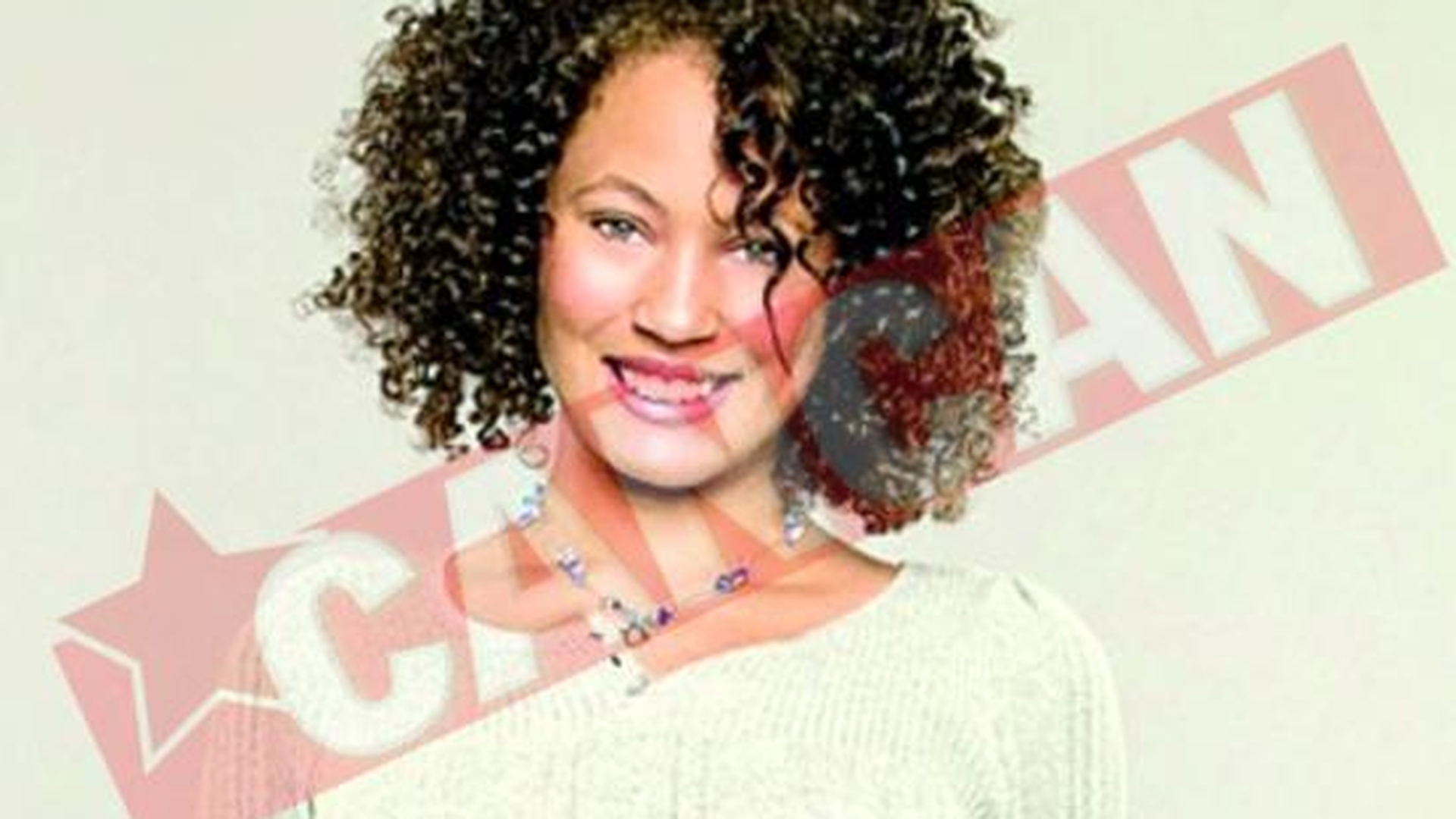 Vrea sa fie supermodel, desi are trupul mutilat de cicatrice