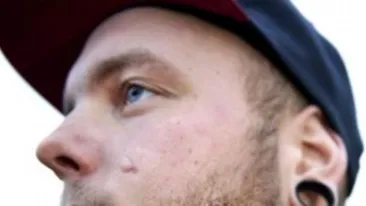 Imagini cu impact emotional! A stat 17 zile cu o bucata de sticla in fata! Medicii nu au vazut ce i-a strapuns obrazul