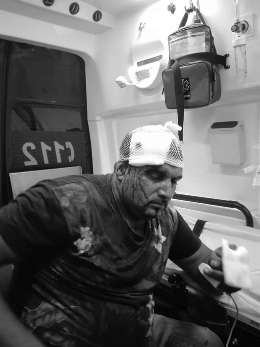 Victima a fost internată cu răni grave la cap