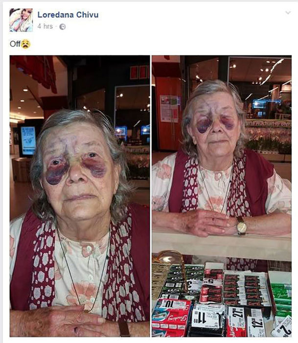 O bătrână a fost bătută cu bestialitate de fiică şi ginere! Imagini şocante şi povestea sfâşietoare a femeii care vrea să scape de acasă