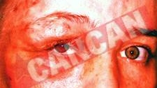 "Sunt pensionata pe caz de boala si am o fata cu o tumora cerebrala"